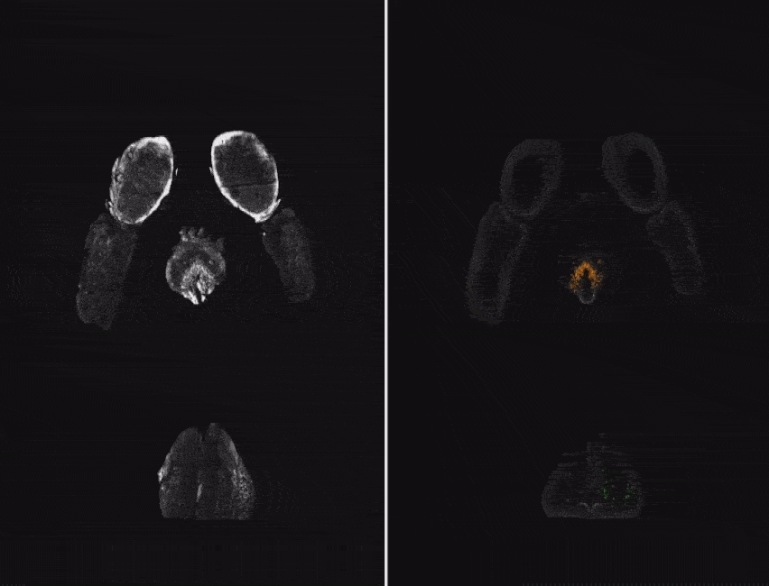 A mouse brain is visualized in black and white with fluorescence. 