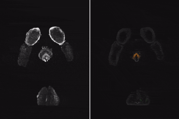 a mouse brain visualized with fluorescence