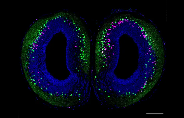 Salamander brain