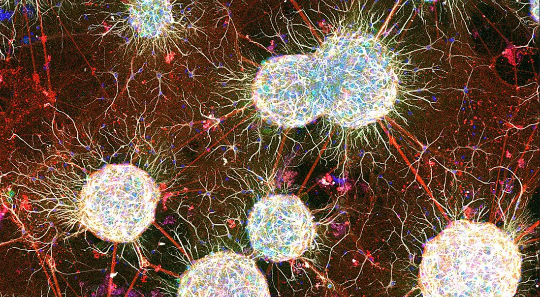 Modular neural networks imaged by the Tomer lab. 