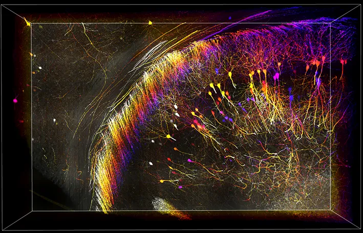 Mouse hippocampus