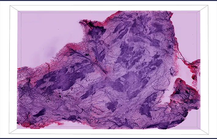 Normal breast tissue histology