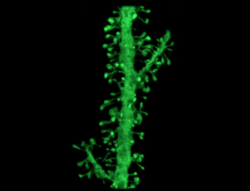 Dendrites and spine from a human neuron.