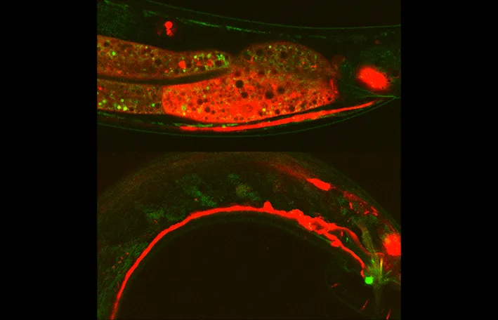 C.elegans is pictured.