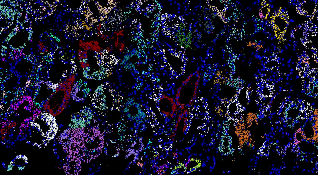 Mapping Multimodal Phenotypes to Perturbations in Cells and Tissue with CRISPRmap. Visualization of in vivo CRISPRmap barcode detection on a xenograft tumor section, showing the guide distribution in the tumor microenvironment. Decoded CRISPR guide-identifying barcodes detected by CRISPRmap are shown as spots false-colored according to their guide identity. Image credit: Gaublomme Lab.