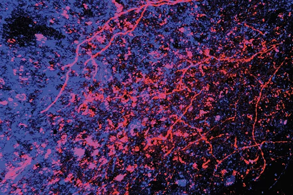 touch receptors