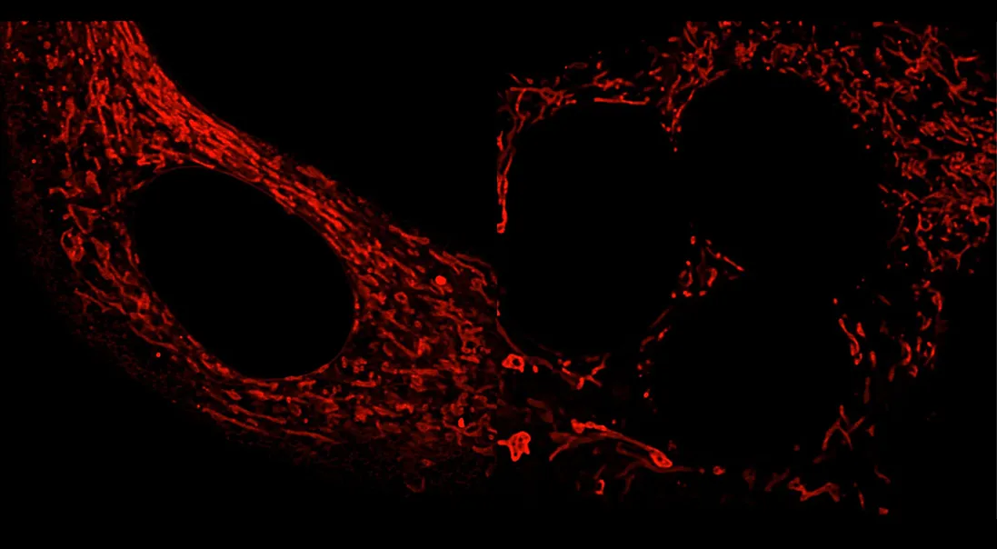An image of mitochondria from Quilin Zhu's research. 
