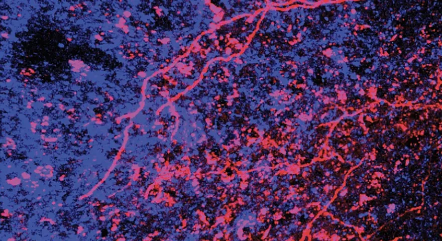zoomed in microscopic image