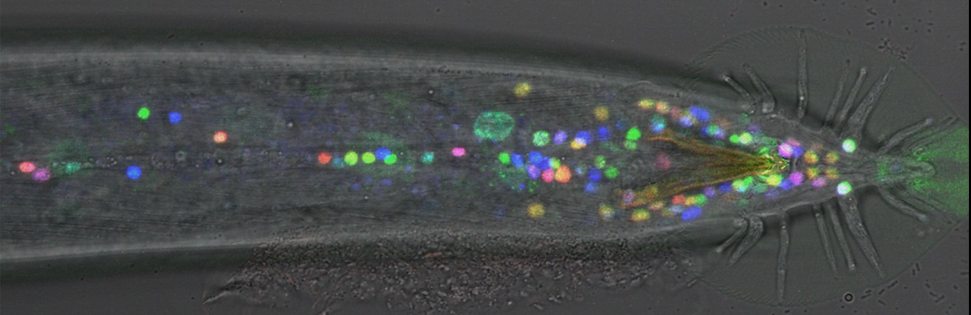 a C. elegans male tail expressing several fluorescent proteins in neurons