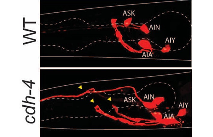 Worm neurons in normal vs cadherin-4 deficient animals (Credit: Maryam Majeed)