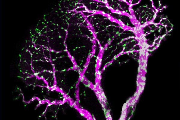 a group of neurons illuminated
