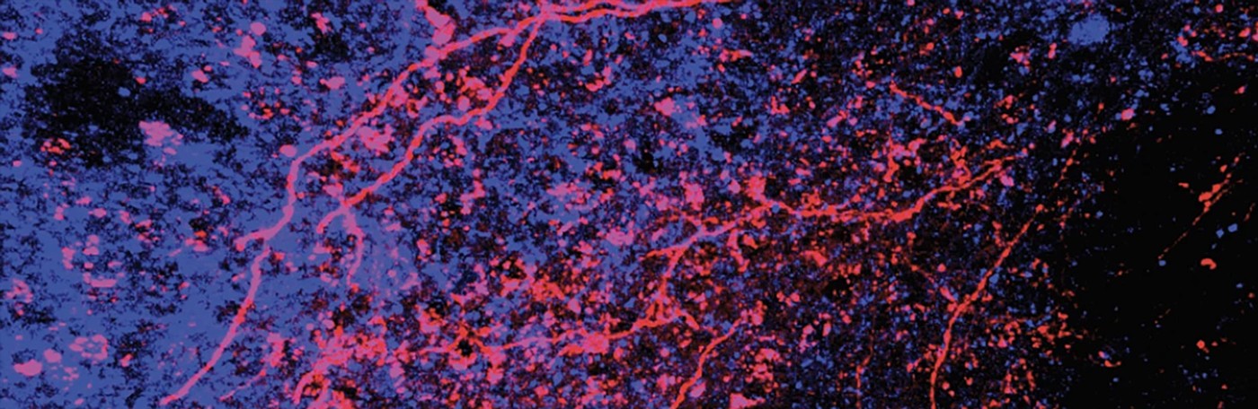 pink and purple splatters appear on a black background