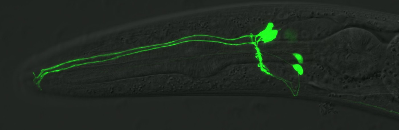 The C. elegans neurons URX and ALA expressing GFP, Credit: G. Robert Aguilar