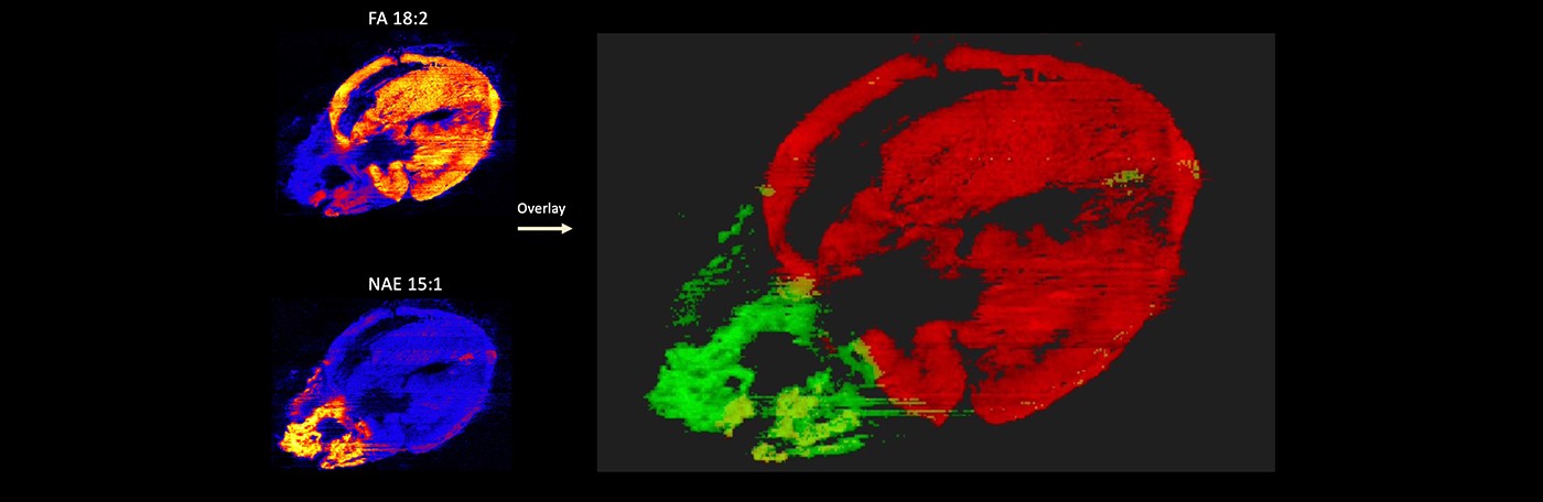 Desorption electrospray ionization- mass spectrometry imaging (DESI-MSI) on a female mouse heart reveals specific distribution of metabolites. Image credit: Stockwell Lab