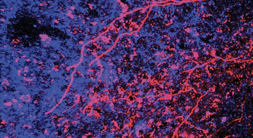 zoomed in microscopic image